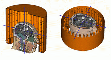図 1：HUGO 頭部モデルと CST MW STUDIO のセットアップ。青色線は電界評価用