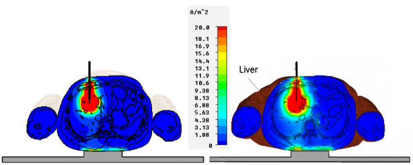 図4：電力損失密度の計算結果：HUGO人体モデル（左）とUAqモデル（右）